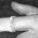 НА СКОРУЮ РУКУ