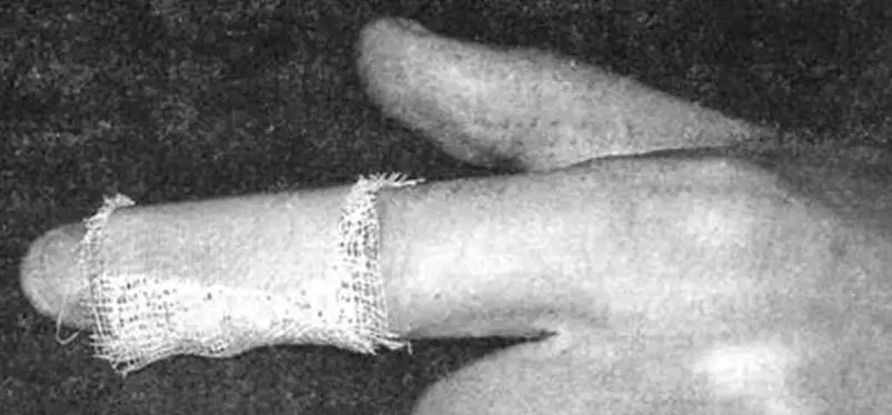 НА СКОРУЮ РУКУ