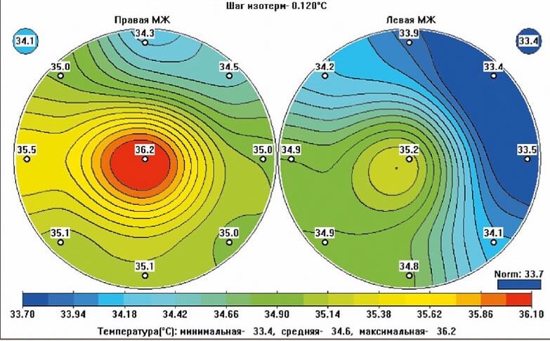 Безопасна ли маммография?